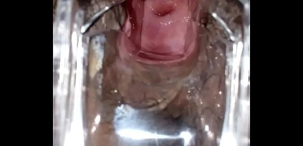  SLIM INDIAN BROWN GIRL CERVIX SPECULUM CHECK VAGINAL OPENING
